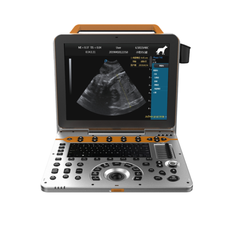 Full Digital Color Doppler Ultrasound System