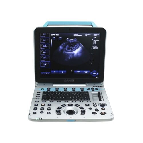 Portable Medical Ultrasound System