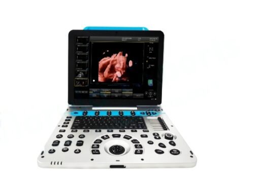 3D/4D/5D Portable Color Ultrasound System